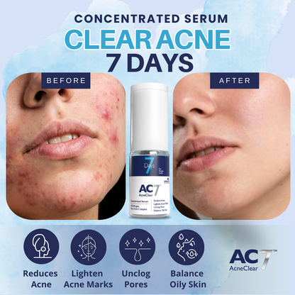 AcneClear7 Days Concentrated Serum (10ml)